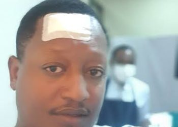 Jk Kazoora after undergoing a successful surgery