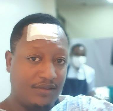 Jk Kazoora after undergoing a successful surgery