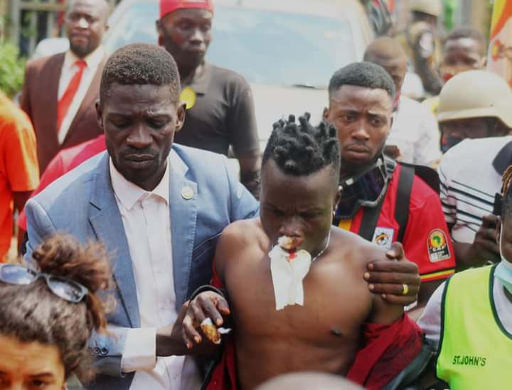 Bobi Wine with his friend Sir Dan Magic who was injured by police