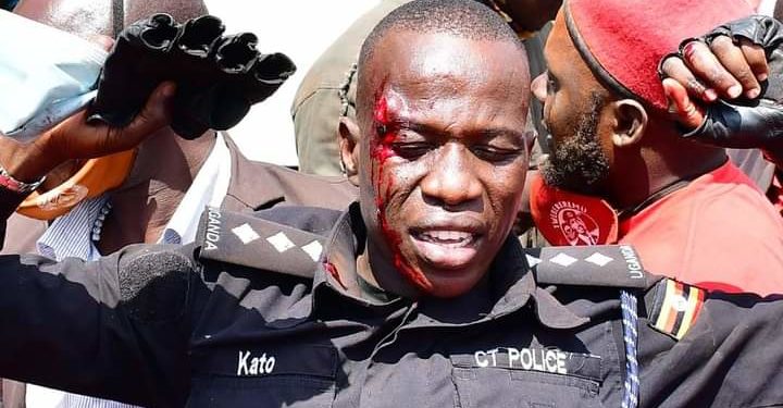 Injured Afande Kato, the head of Bobi Wine police security detail being taken to hospital