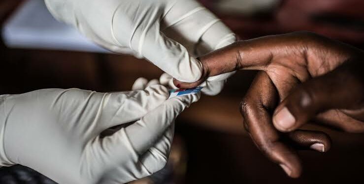 Doctor conducting HIV/AIDS test