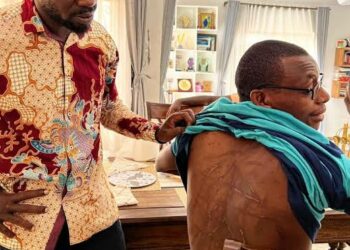Writer Kakwenza Rukirabashaija showing off the torture marks on his body