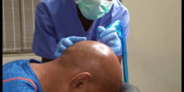 A Dermatologist set to start carrying out a scalp micro pigmentation procedure on a patient after preparing them fully for the session