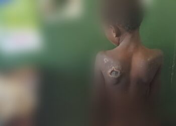 Victim of torture Catherine Kisakye